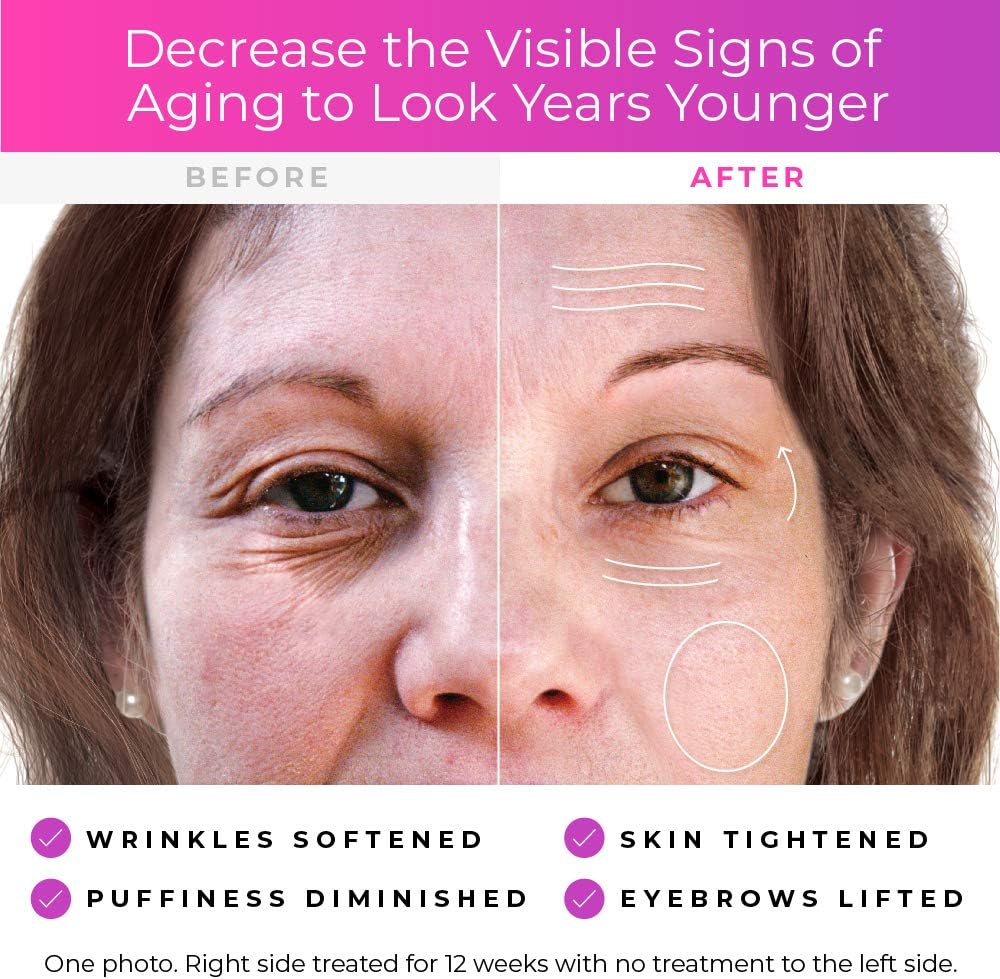 resultados dermawand antes y despues